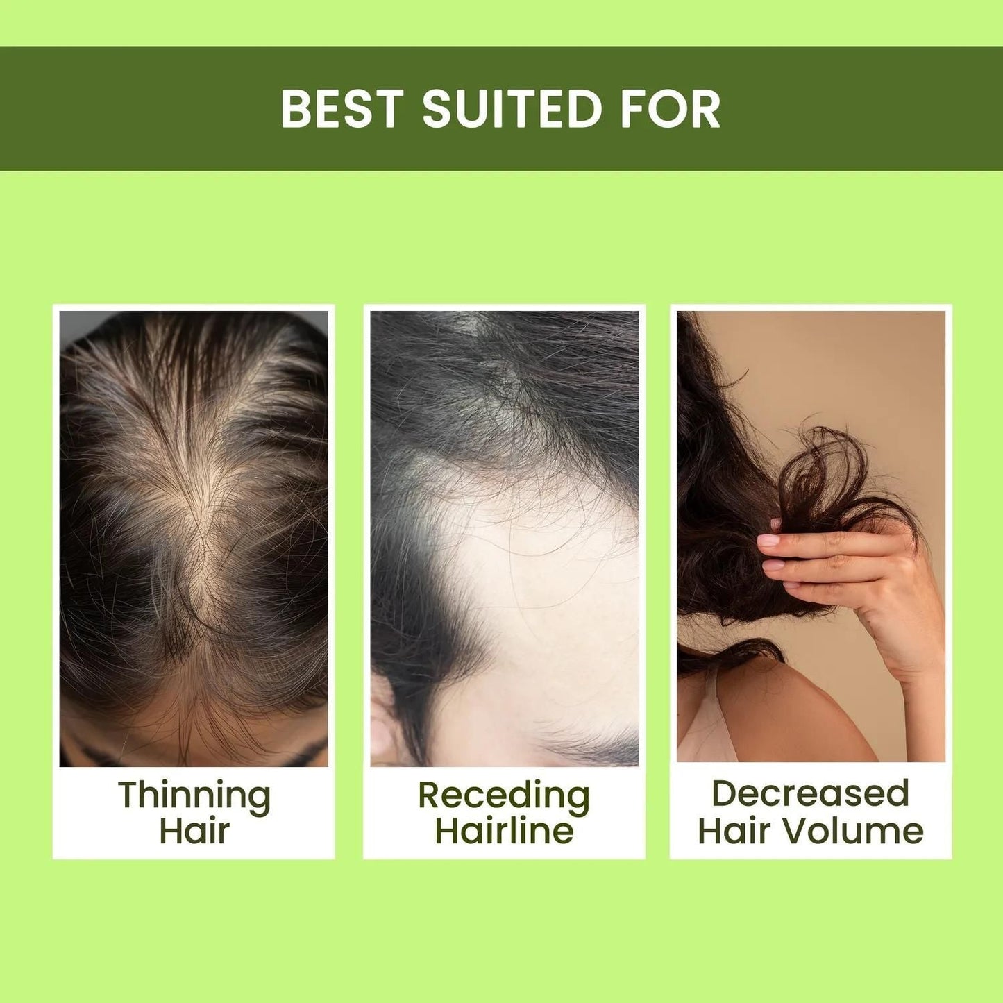 Rosemary Water, Hair Spray For Regrowth Buy 1 Get 2 Free da075y-ar